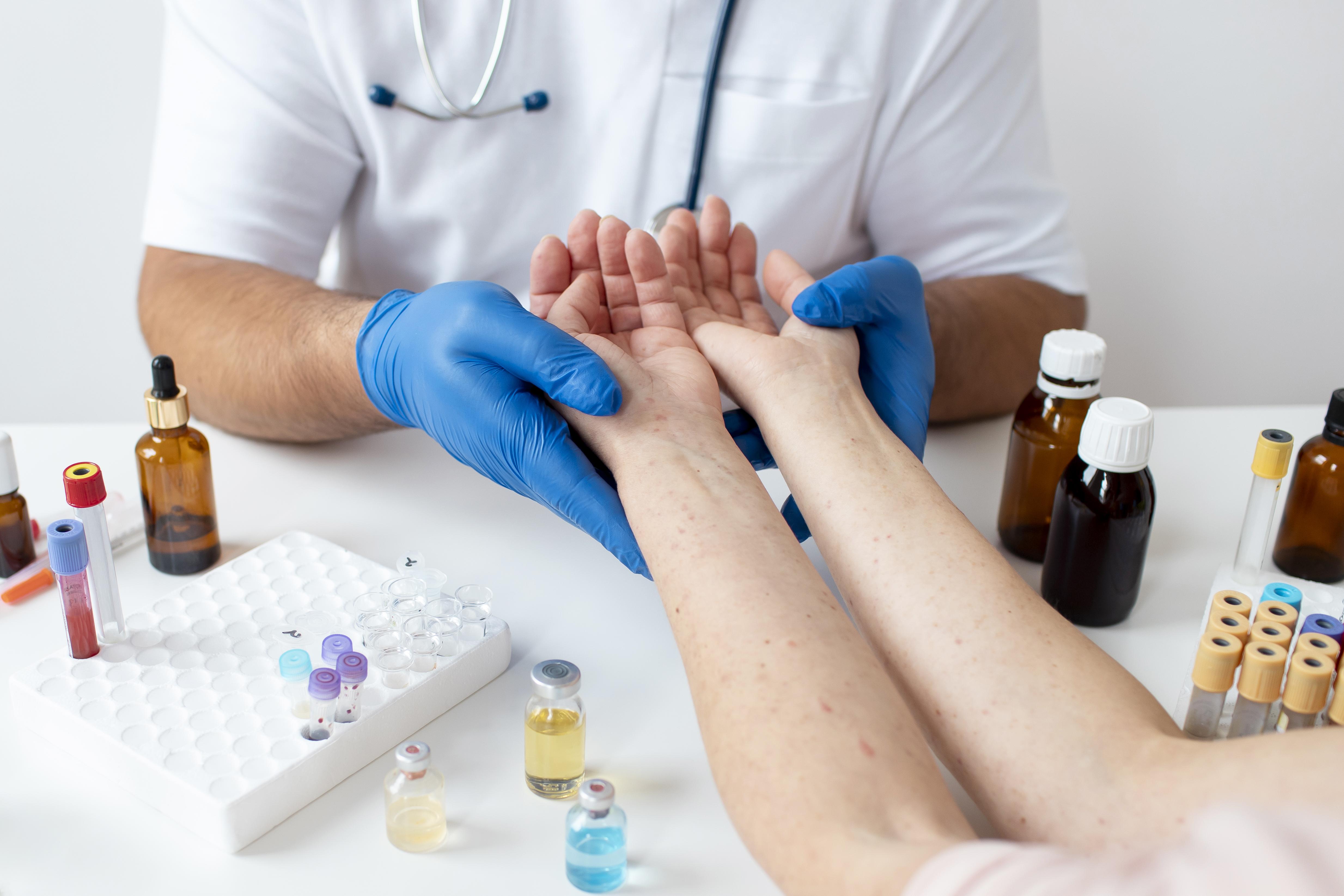 Allergy Testing